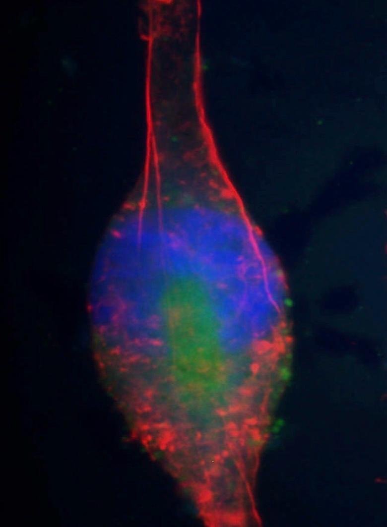 Fluorescence & Light Microscopy